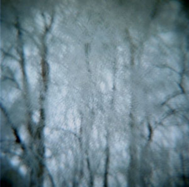 Winter Trees, Angelika Schilli